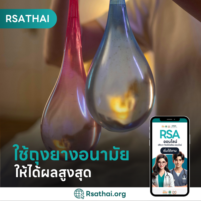 How Condoms Help How to use a condom effectively