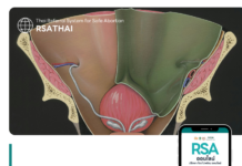 ทำไมการขูดมดลูกไม่ปลอดภัย? ทางเลือกใหม่ที่ WHO แนะนำ